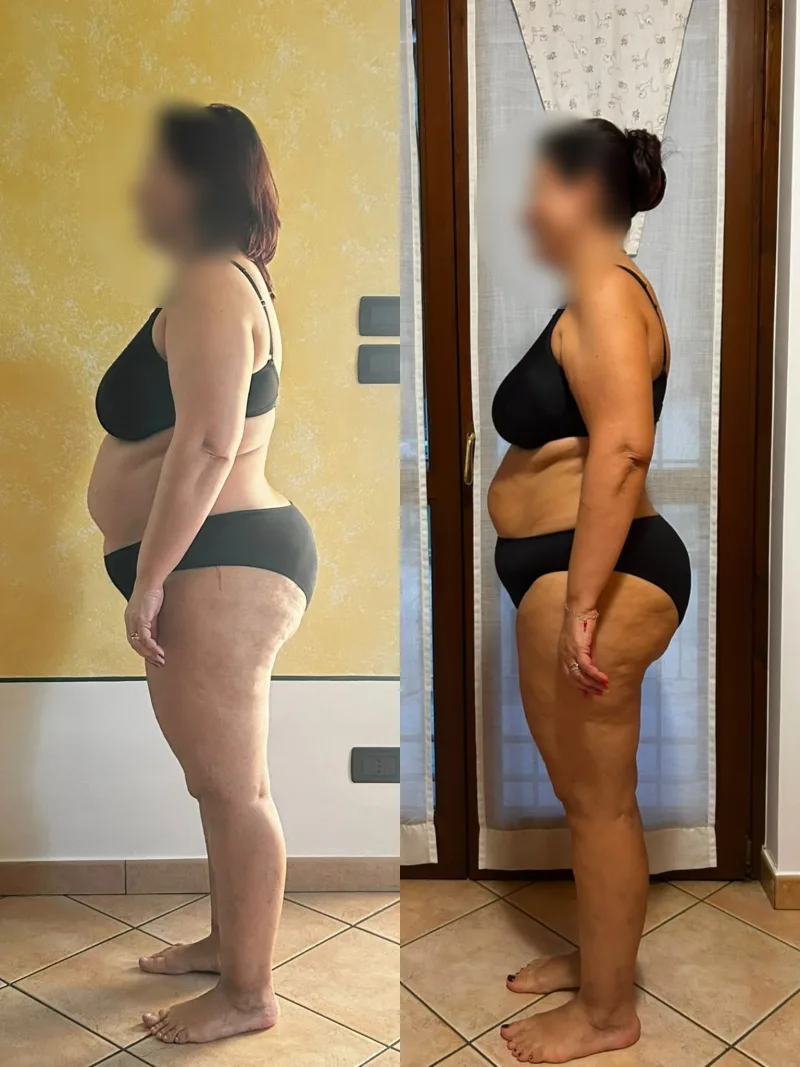 Prima e dopo, profilo